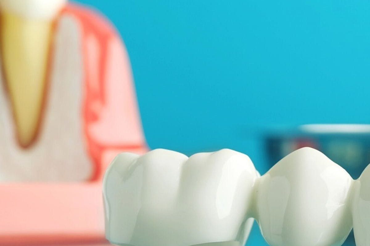 Close-up of Fake Teeth Lying on a Glass Surface