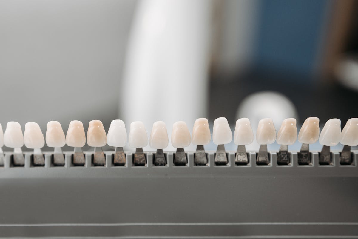 Different Shades of Veneers