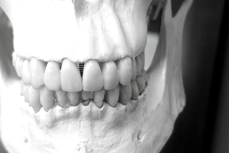 A Skull with Teeth