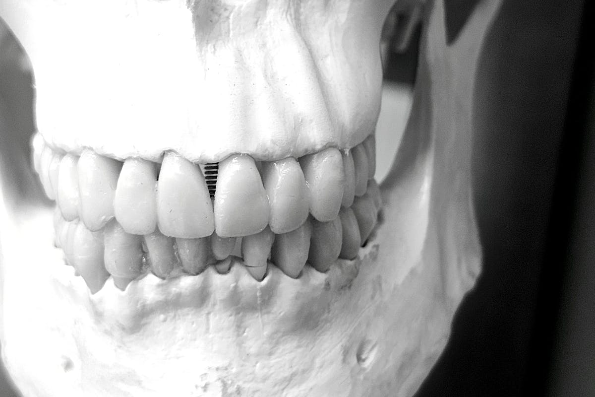 A Skull with Teeth