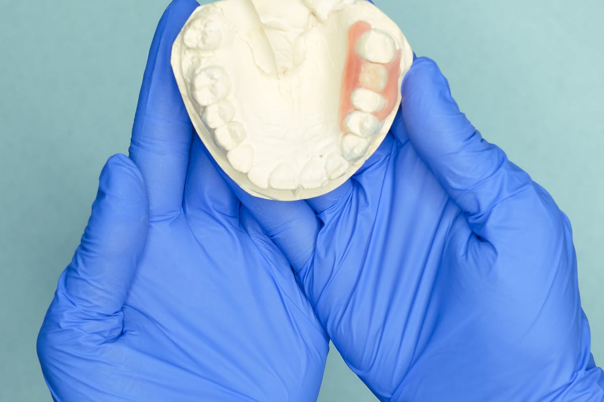 Hands in Gloves Holding of Dental Prosthesis