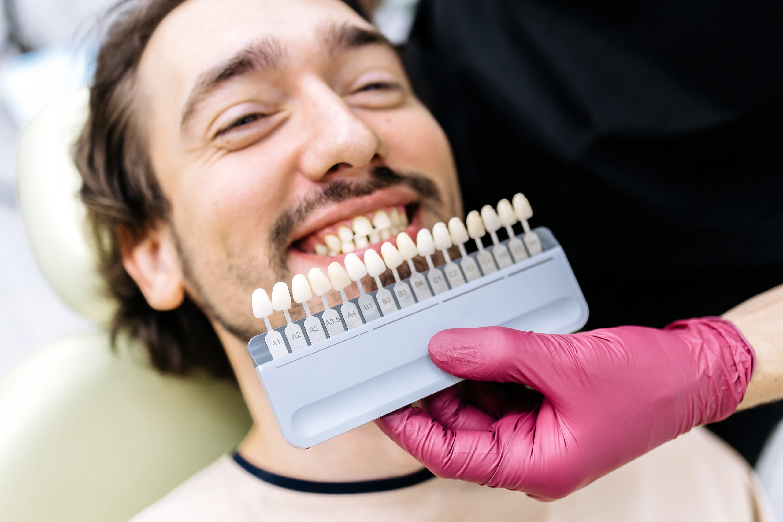 Male patient with a smile as a dentist holds a tooth shade guide to select the appropriate color in a modern dental clinic environment
